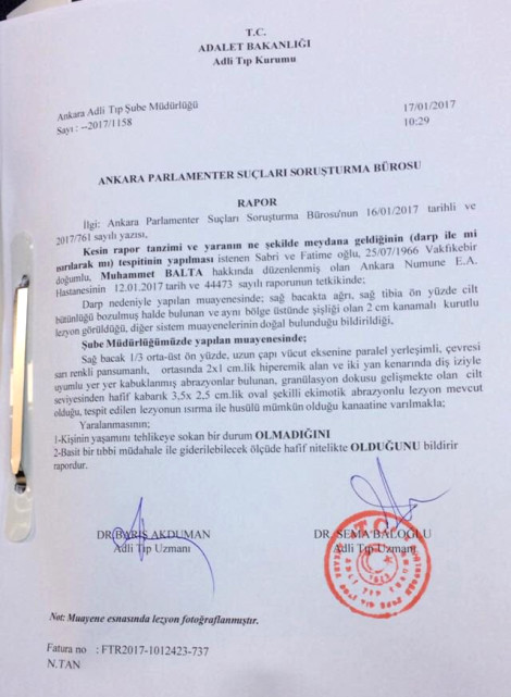 Savcılık, bacağından ısırılan AK Partili vekilin şikayetiyle soruşturma başlattı